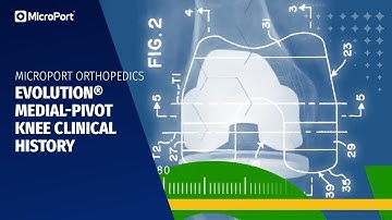 Evolution® Medial-Pivot Knee Clinical History