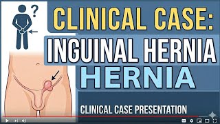 INGUINAL HERNIA (L-1) | CLINICAL CASE PRESENTATION | Surgery Practical