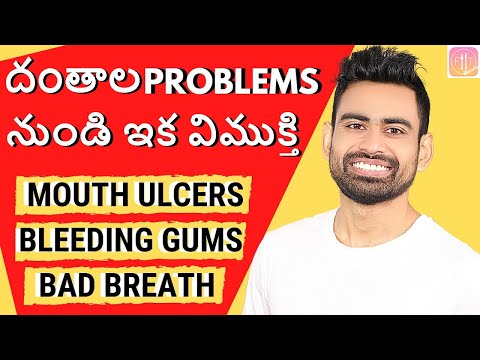 దంత సమస్యల నుండి పొందండి శాశ్వత ఉపశమనం (Mouth Ulcers, Bleeding Gums, Bad Breath, Cavities)