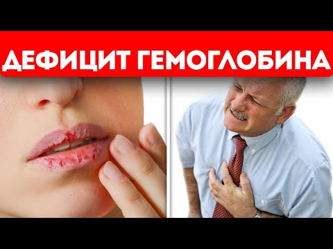 Глянь в зеркало! 7+ симптомов низкого гемоглобина и как пополнить гемоглобин в крови