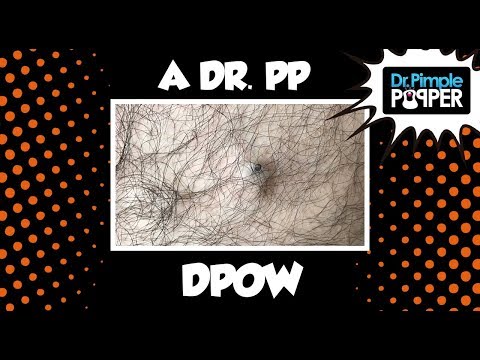 The Jungle Is Dark, But Full Of Diamonds... A Dr Pimple Popper DPOW