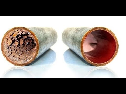 Video: Che cos'è un tubo di pulizia settico?
