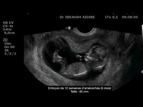 Vidéo: 12 semaines de développement du bébé