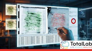 SpotMap 2D: Export Protein Spot Data to Excel & CSV (2D Gel Imaging)