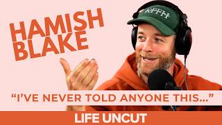The Most Embarrassing Story He’s Never Told. Uncut with Hamish Blake