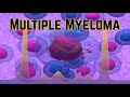 Multiple Myeloma (Updated 2018) -- CRASH! Medical Review Series