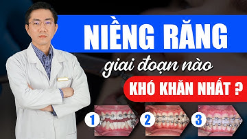 Niềng Răng Giai Đoạn Nào Là Khó Khăn Nhất | Nam Bùi Vinalign