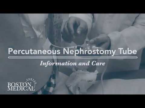 Video: Nephrostomy Tube: Care, Placement, Removal A Další