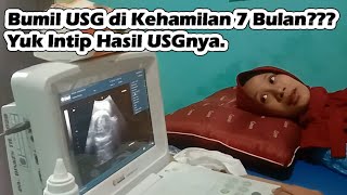 Bumil Usg Di Kehamilan 7 Bulan? Yuk Intip Hasil Usgnya.