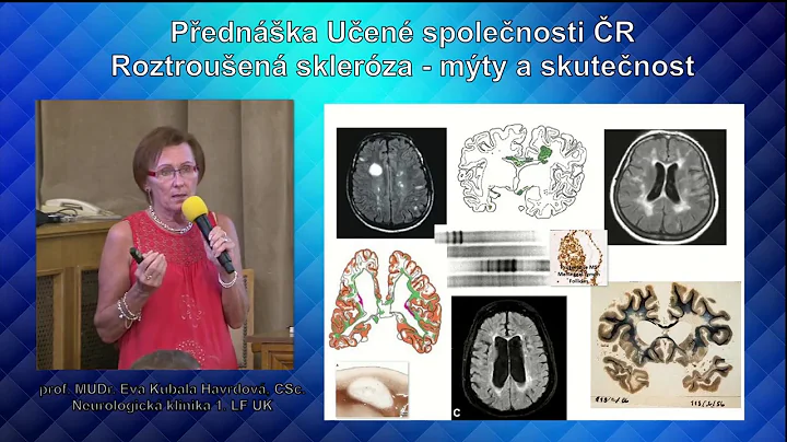 Eva Kubala Havrdov: Roztrouen sklerza  mty a skute...