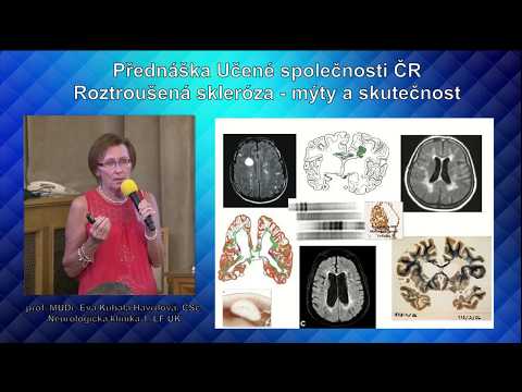 Video: Doctor Discussion Guide: Nově Diagnostikovaná S RS