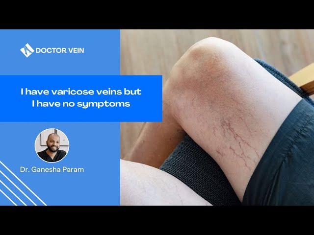 Do Compression Stockings Cure Varicose Veins? 