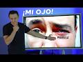 ¡Se me infectó el ojo! ¿Qué sucedió y cómo evitarlo? | Perrilla/Orzuelo