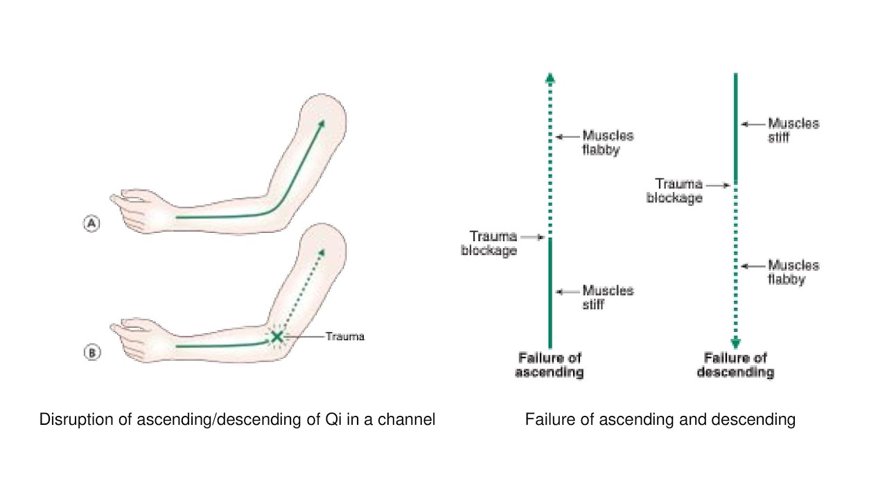 PATHOLOGY OF ASCENDING/DESCENDING OF QI IN THE CHANNELS - YouTube