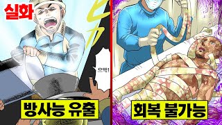 [실화] 히로시마급 방사능에 피폭된 남자... 온몸의 피부가 통채로 벗겨지다