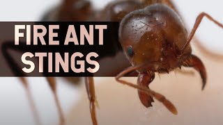 Fire Ant Stings Explained by Sticking My Leg in an ANT NEST!
In this video were diving into fire ants and exploring the stings of fire ants.
A big thanks to all current and future patrons who are helping fund this science and filmmaking outreach via patreon: http://bit.ly/2Sfmkph
#insects, #ants, #theantsundergroundkingdom
Don’t forget to follow me on Instagram: https://www.instagram.com/untamedscience/
📲 Install The Ants: Underground Kingdom Today! https://theants.onelink.me/joeb/JoinStoneAgeMan 💥
We make all these videos ourselves with this gear
Main DSLR : https://amzn.to/2Sho2qc
Second Camera : http://amzn.to/2B9HInR
Main Lens - http://amzn.to/2BaEXTk
The Adventure Camera Bag : http://amzn.to/2B8WYRH
The Macro Lens - http://amzn.to/2hHUhxW
Telephoto Lens - http://amzn.to/2za1FJV
Our MegaWide Lens - http://amzn.to/2z9KtnS
Our BEST oncamera Mic - http://amzn.to/2hGuSVt
The Drone - http://amzn.to/2z84Bqc
My Moving Timelapse setup - https://amzn.to/2SeCZcJ
GoPro HERO 7 - https://amzn.to/2ShoPHG
Our Filmmaking Book!!! - http://amzn.to/2zV88LS
Our music: https://goo.gl/roSjb7
The full video setup: https://kit.com/UntamedScience
(By buying through these links you help us support the channel)
If you want to see how we do the videos we have a channel dedicated to video Edu: https://www.youtube.com/robnelsonfilms
On Social
Instagram: https://www.instagram.com/untamedscience/ (Jonas @behindthescience)
Twitter: https://twitter.com/untamedscience
Facebook: https://www.facebook.com/untamedscience
Website: http://www.untamedscience.com
Jonas and I are creating a whole series of how-to-filmmaking videos to get you started. Here is the first video: http://bit.ly/2AcYvHJ and our book: http://amzn.to/2zV88LS
Help us create amazing, world reaching content by translating and transcribing videos on our channel: http://bit.ly/2Crnjgu Fire Ant Stings Explained by Sticking My Leg in an ANT NEST!
