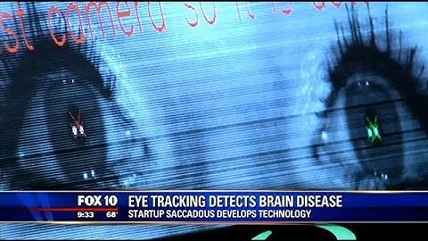 Eye tracking technology detects brain disease