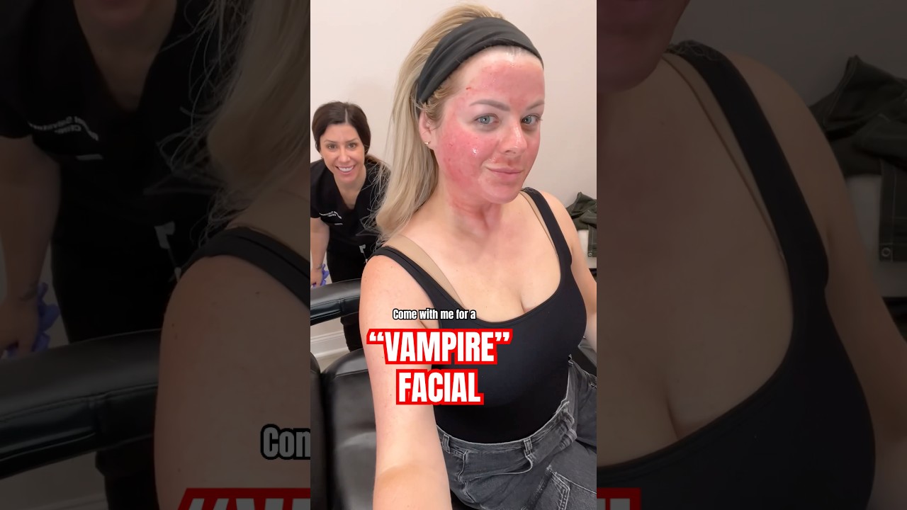 Come with me for a “VAMPIRE FACIAL”🫢🩸💉(SkinPen Microneedling + PRF) 📍Scranton JAN 