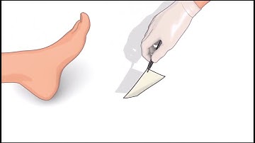 ADAPTIC™   COMO USAR