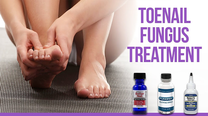 What is the best over the counter medicine for toenail fungus