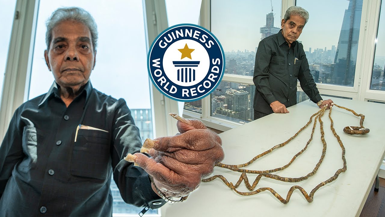 82-year-old Shridhar Chillal with longest nails finally trims them after 66  years | City - Times of India Videos