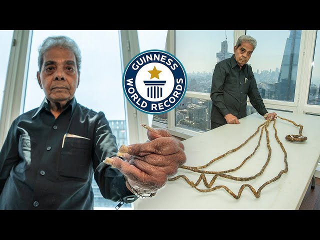 Why He Cut His Nails After 66 Years - Guinness World Records class=