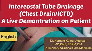 Intercostal Tube Drainage-A Live Demonstration in Patient (English) (Chest Drain/ ICTD) # Chest Tube