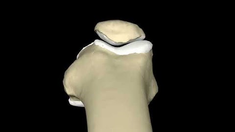 Relative motion of the patella