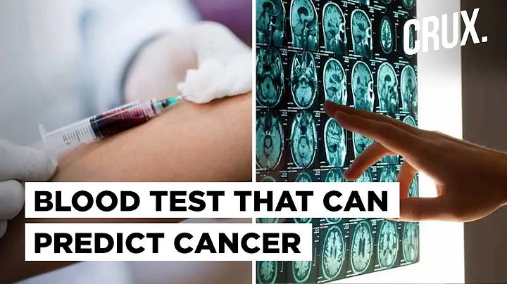 Cancer Breakthrough? Blood Test Can Diagnose Cancer In Earliest Stage Or Tell You're Safe For A Year - DayDayNews