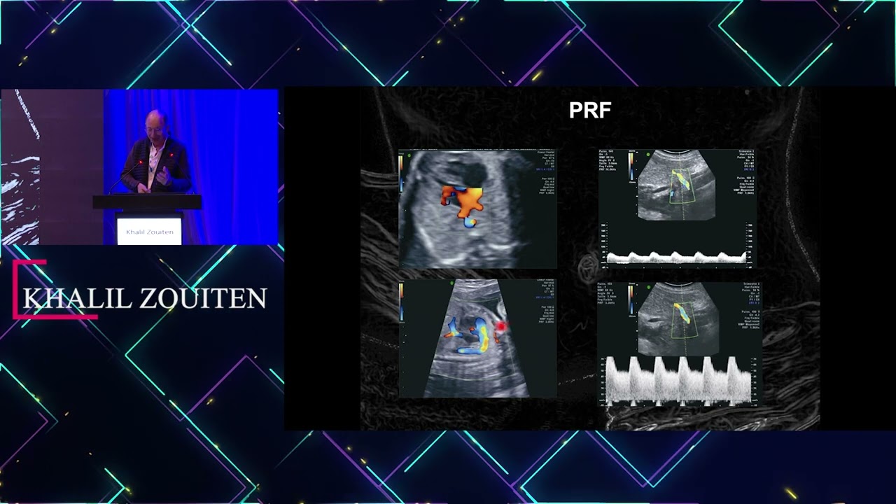 Les journées d'échographie: Comment réussir son Doppler en obstétrique: Khalil Zouiten
