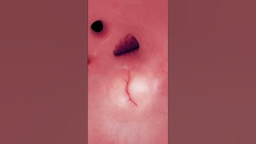 Bringing the Heart to Life: Inside Our Animated Model #anatomy #3dmodel #meded