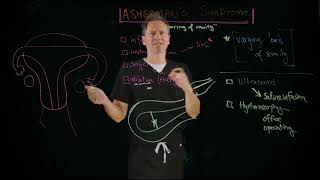Ashermans Syndrome An Introduction
