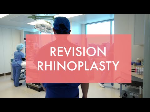 Rhinoplasty Revision Surgery