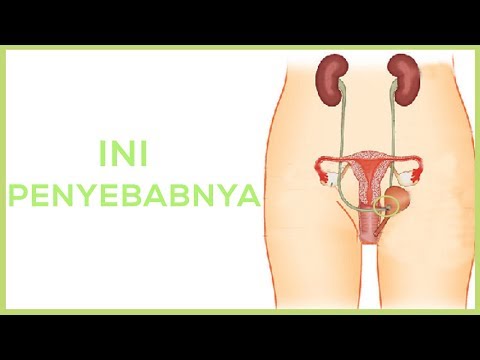 Video: Mengapa vulvovaginitis terasa gatal?