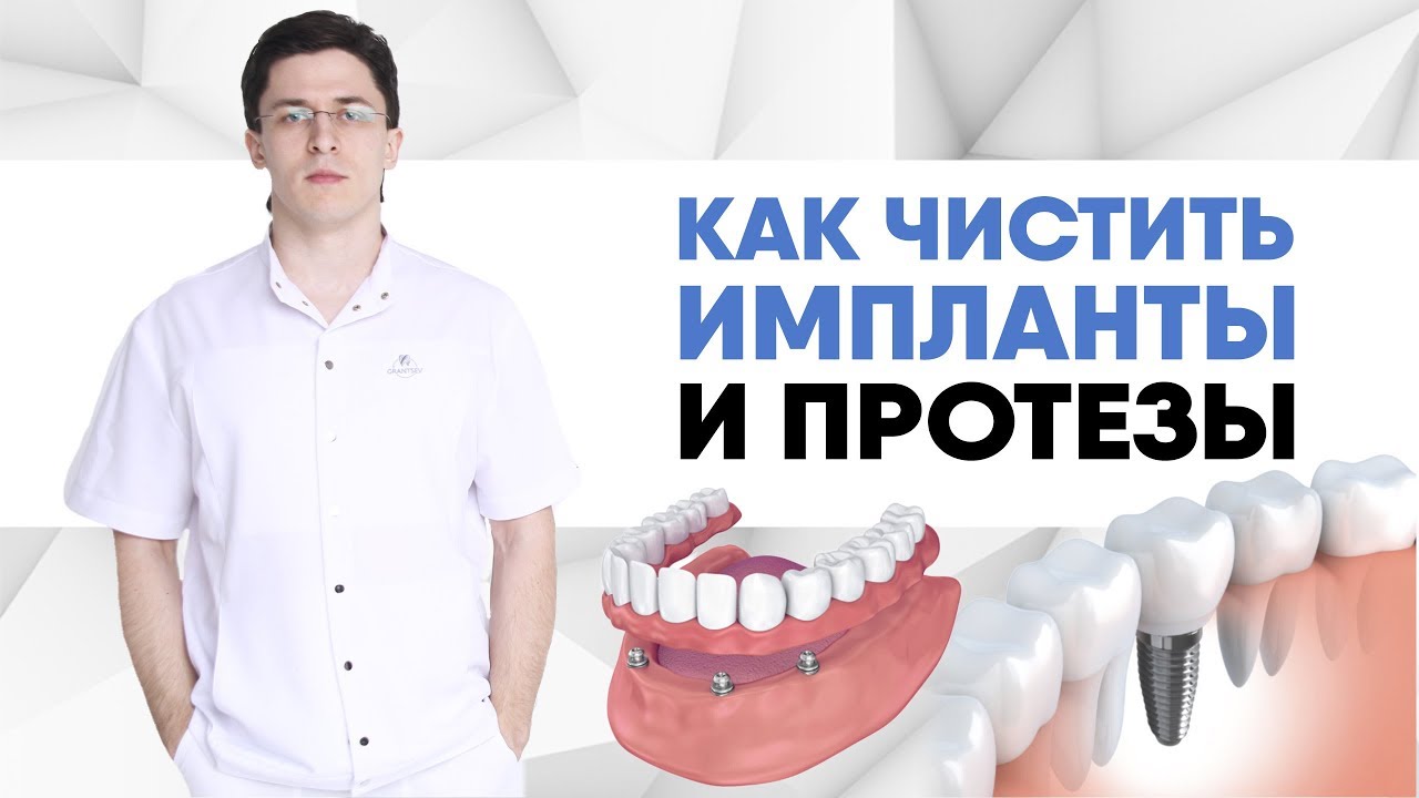 Как чистить импланты и протезы. Чем чистить импланты? Надо ли чистить ...