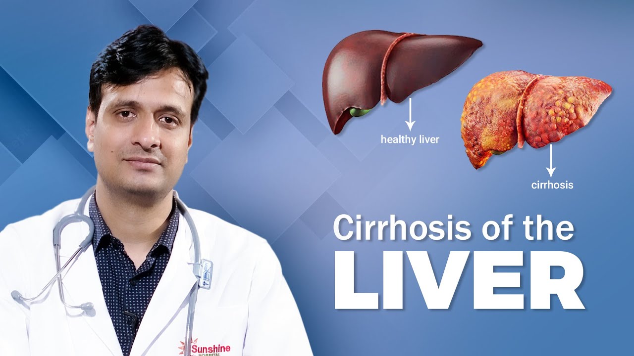Everything You Need To Know About Liver Cirrhosis | Dr. Shakti Prasad Choudhury | Swasthya Sambad