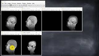 009 2D and 3D Display Options for Stacks (ImageJ-Fiji Course)