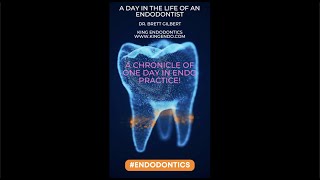 A DAY IN THE LIFE OF AN #ENDODONTIST!  A REAL LIFE CHRONICLE OF A SINGLE DAY IN ENDO PRACTICE!