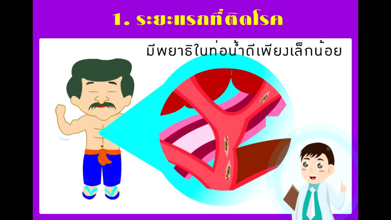 โรคพยาธิใบไม้ตับ