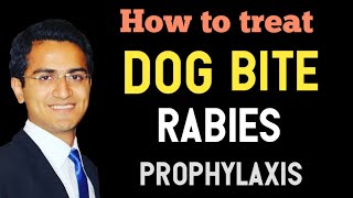 Dog Bite (Rabies Virus) Emergency Treatment, Rabies Symptoms,PostExposure Prophylaxis Vaccine USMLE