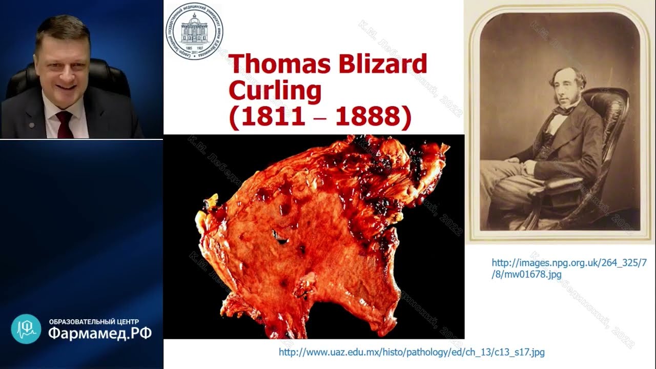 Проблема адекватности анестезии Лебединский К.М.