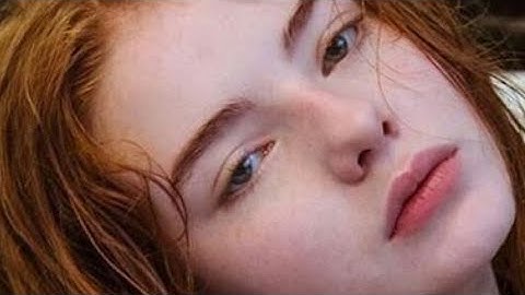 remove closed comedones