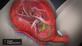 Hypoxic Anoxic Brain Damage Explained #personalinjurylawyer #shorts #medicalmalpracticelawyer