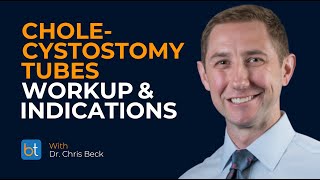 Cholecystostomy Tubes Workup & Indications | BackTable Clips