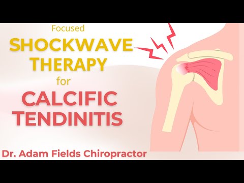 Help CalcificTendinitis w/ Shockwave Therapy | Extracorporeal Shockwave Therapy | ESWT