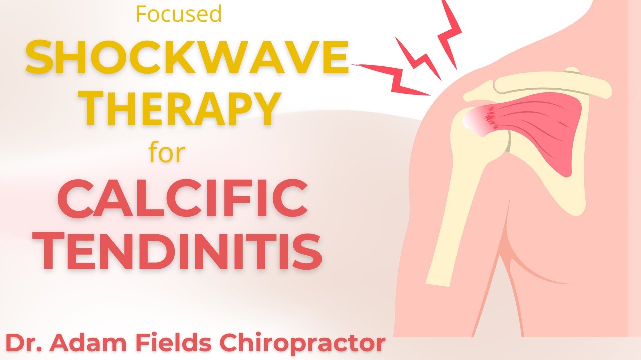 Help CalcificTendinitis w/ Shockwave Therapy | Extracorporeal Shockwave Therapy | ESWT