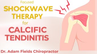 Help CalcificTendinitis w/ Shockwave Therapy | Extracorporeal Shockwave Therapy | ESWT