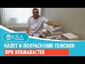 ▶ Налет и покраснение головки при dermabacter. Клинический случай №948