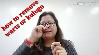 PAANO GAGAMUTIN ANG KULUGO,( How To Remove Warts? PAANO GAGAMUTIN ANG KULUGO,( How To Remove Warts?