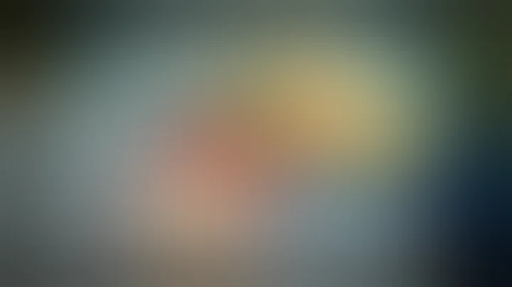 How to place a Portacath (Mediport Insertion)